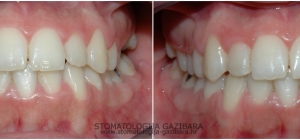 Restorativna stomatologija
