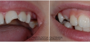 Restorativna stomatologija