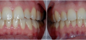 Restorativna stomatologija